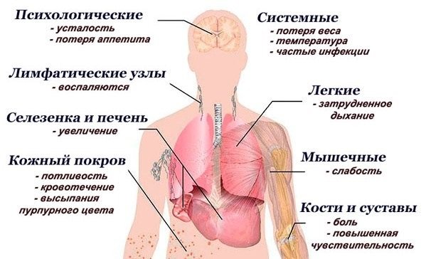 Симптомы лейкемии на ранней стадии выражены слабо, и могут долго не обращать на себя внимания