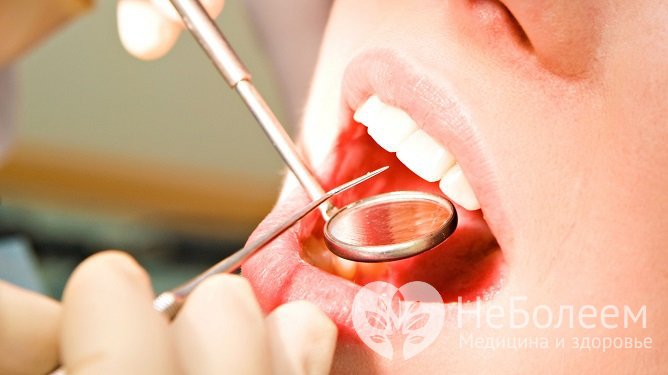 Биопсия с пораженного участка позволяет подтвердить лейкоплакию полости рта