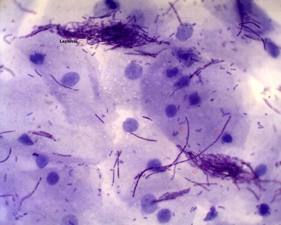 Лептотриксы при микроскопии имеют вид пучка перепутанных нитей