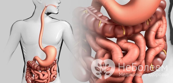 Острый гастроэнтерит – это воспаление слизистой оболочки желудка и тонкого кишечника