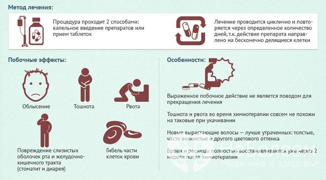 Лечение острого лейкоза проводится методом химиотерапии