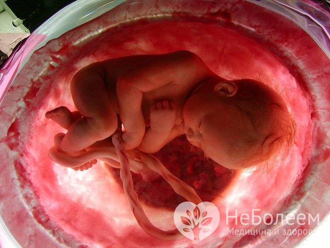 Пневмония у новорожденного может быть следствием внутриутробного инфицирования