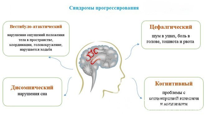 Симптомы резидуальной энцефалопатии головного мозга