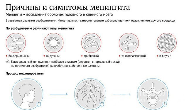 Причины серозного менингита