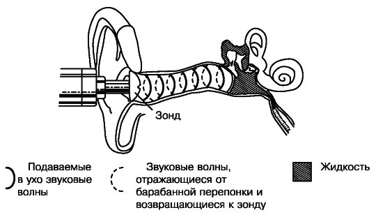 Методы диагностики среднего отита