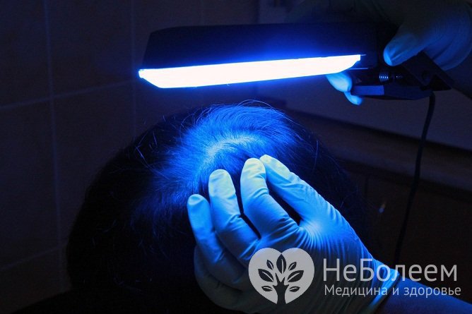 С целью диагностики стригущего лишая применяют люминесцентное исследование под лампой Вуда