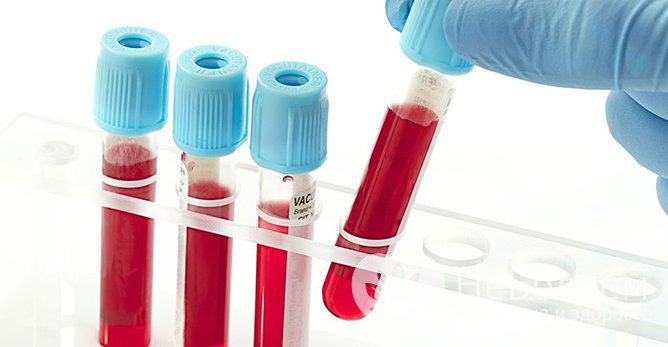 При необходимости уточнения диагноза назначается клинический анализ крови
