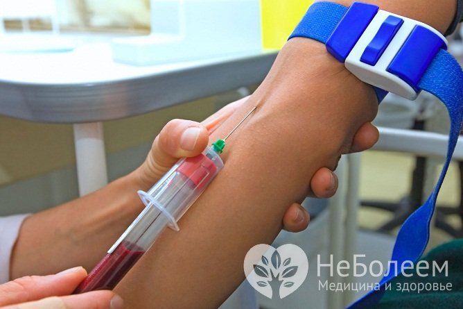 Анализ крови позволяет выявить причину, по которой появляются трещины на языке