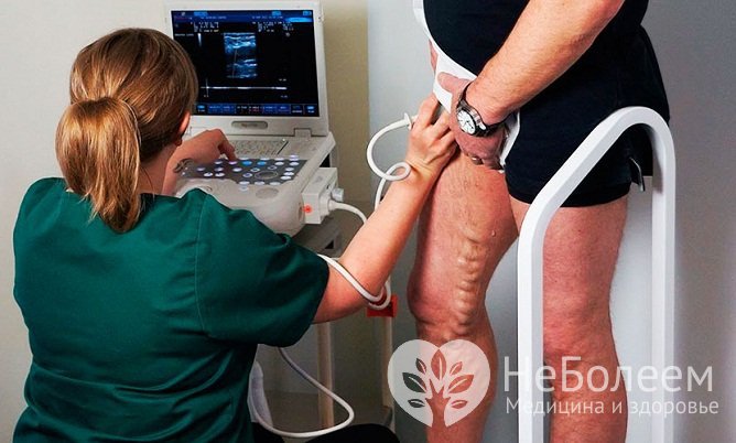 Достоверный вид диагностики венозной недостаточности – допплеровское ультразвуковое сканирование