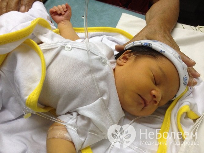 Желтуха у новорожденных: причины и лечение