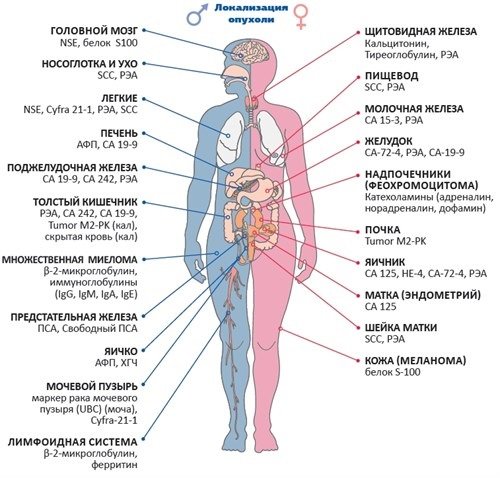 Распространенные виды злокачественных опухолей у женщин и мужчин
