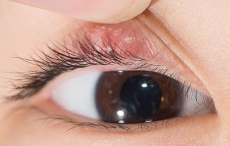 6 свидетельствующих о болезнях изменений глаз