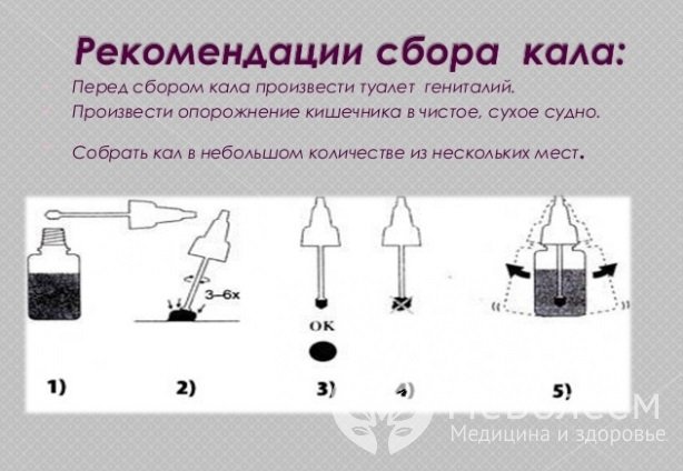 От того, насколько будут соблюдены правила сбора и хранения кала, зависит достоверность результата анализа