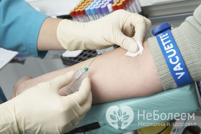 Для определения ХГЧ кровь забирается из вены