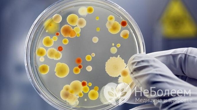 Для острых инфекций характерна монокультура бактерий, для хронических – бактериальные ассоциации