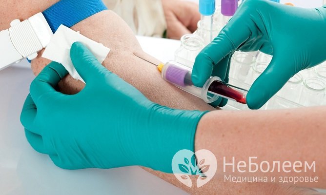 Анализ на витамин D: для чего нужен и как его сдать?
