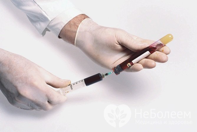 Для диагностики гепатита C применяются несколько анализов, кровь для которых берется из вены