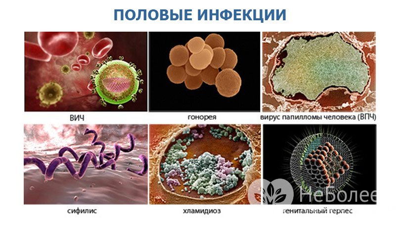 Возбудители венерологических заболеваний