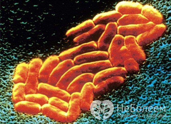 Существует предположение, что развитие озены связано с Klebsiella pneumoniae ozaenae