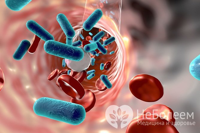 Бактерии из очагов воспаления могут распространяться через кровь или лимфу