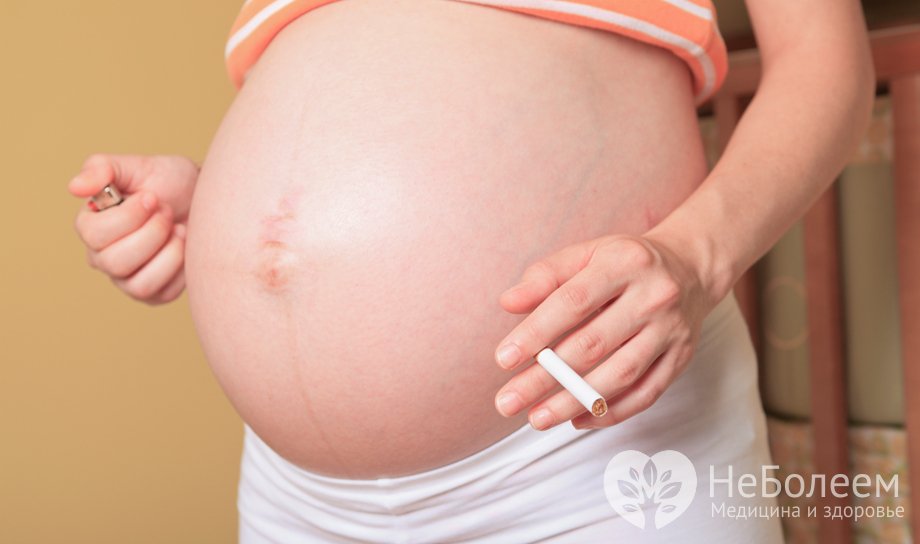 Беременность и курение