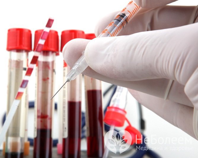 Биохимический анализ крови - одно из базовых исследований, которое назначается при большинстве заболеваний внутренних органов, а также в профилактических целях