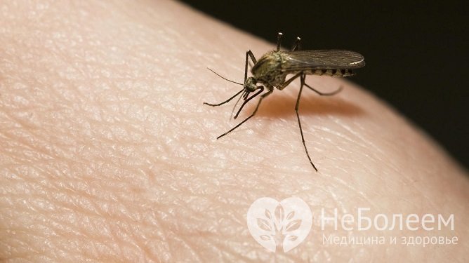 При повышенной чувствительности организма укус любого насекомого может вызвать не только значительный отек, но и другие неприятные симптомы