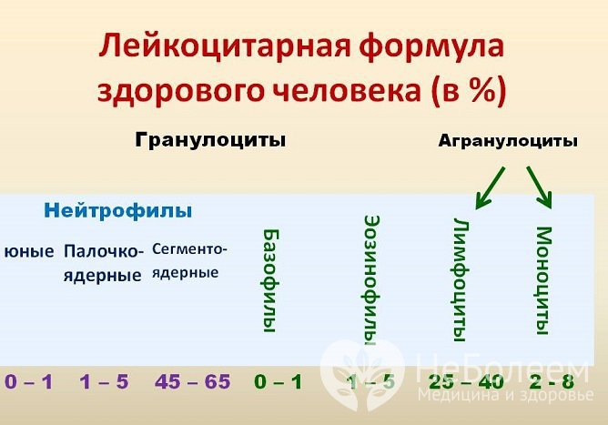 Изменения лейкоцитарной формулы позволяют диагностировать целый ряд заболеваний, в том числе лейкоз