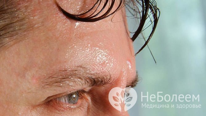 Гипергидроз головы и лица: причины, лечение