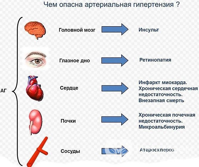 В отсутствие лечения гипертоническая болезнь может иметь опасные последствия