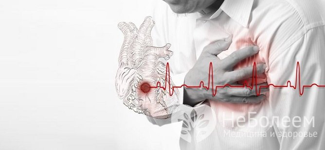 Основным признаком инфаркта является ангинозная боль в области сердца