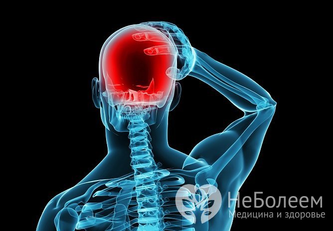Повышенное внутричерепное давление проявляется, главным образом, головной болью
