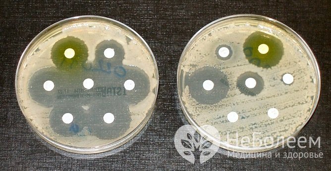 В ходе бактериологического анализа определяется чувствительность микроорганизмов к антибиотикам