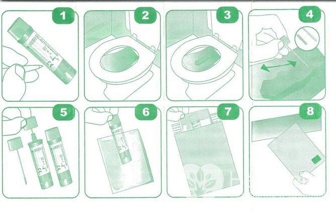 Для анализа следует собирать кал после самопроизвольной дефекации, использовать клизму или слабительное не следует