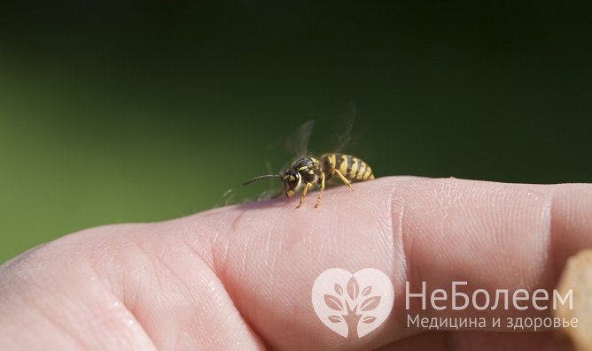 Как снять отек от укуса осы