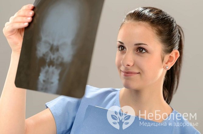 Для постановки диагноза может быть назначено рентгенологическое исследование придаточных пазух носа