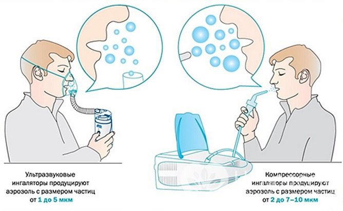 Выбор типа ингалятора определяется целью его использования