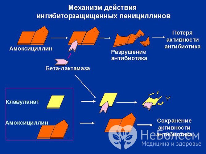 При лечении бактериального ларингита обычно назначаются защищенные пенициллины