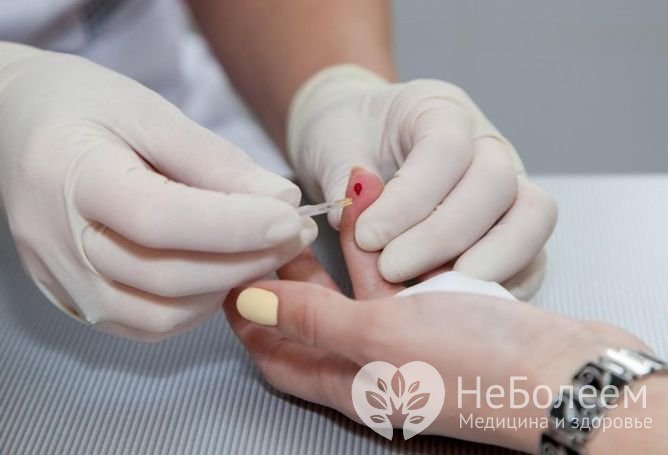 Расшифровка результатов общего анализа крови