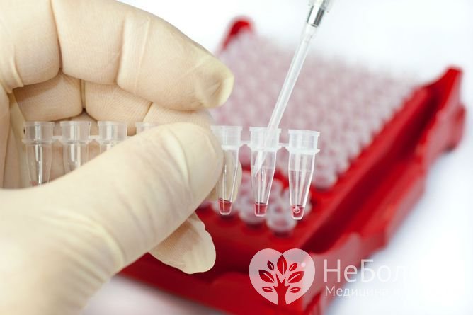 Развернутый анализ крови назначается для диагностики заболеваний, а также контроля хода лечения