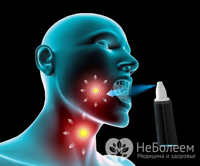 При терапии ларингита эффективно применение местных препаратов – спреев, таблеток для рассасывания