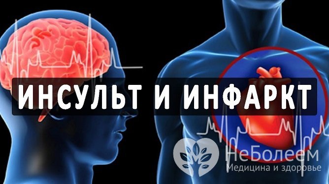 Несмотря на все отличия, у инсульта и инфаркта немало общего