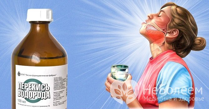 Полоскание горла перекисью водорода при ангине: можно ли, особенности применения