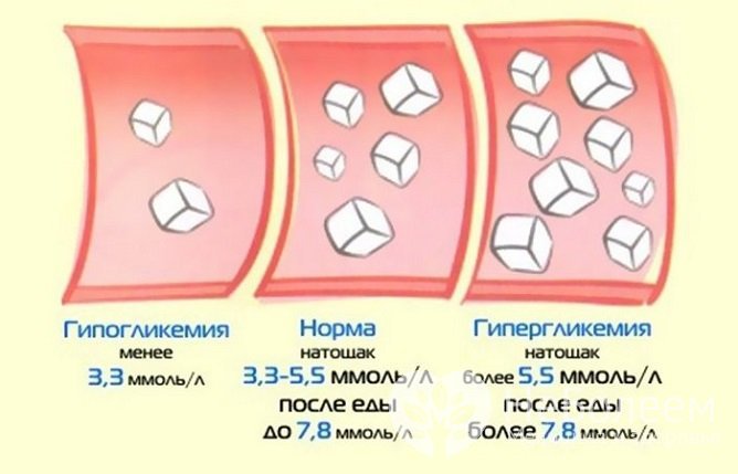 Повышение уровня сахара в крови называется гипергликемией