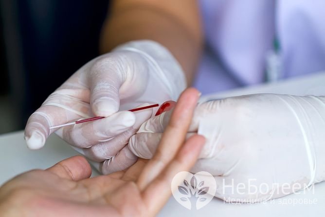 Кровь для клинического анализа обычно берут из пальца, но в некоторых случаях – из вены
