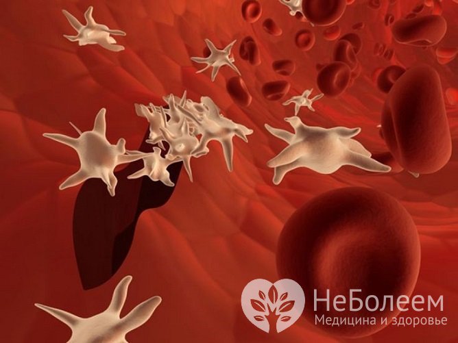 Пониженное количество тромбоцитов в крови у ребенка становится причиной кровоточивости