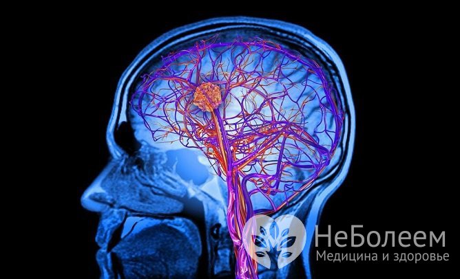 Следствием ринита может быть гипоксия тканей головного мозга