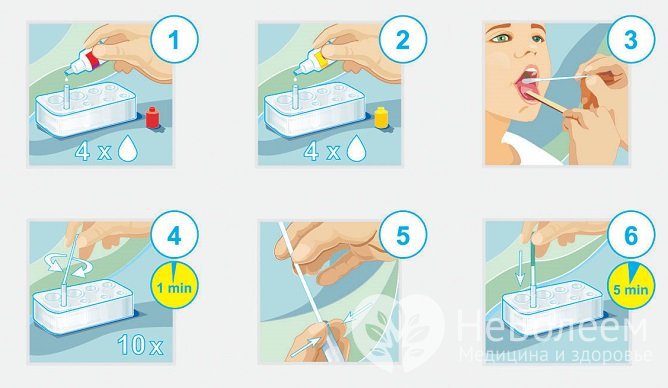 При подозрении на бета-гемолитический стрептококк группы А проводится экспресс-тест