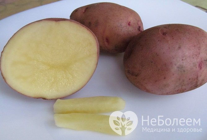 Облегчить симптомы внутреннего геморроя могут самодельные свечи из сырого картофеля