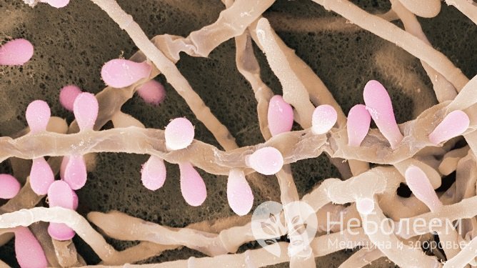 Возбудителями микоза служат микроскопические грибки